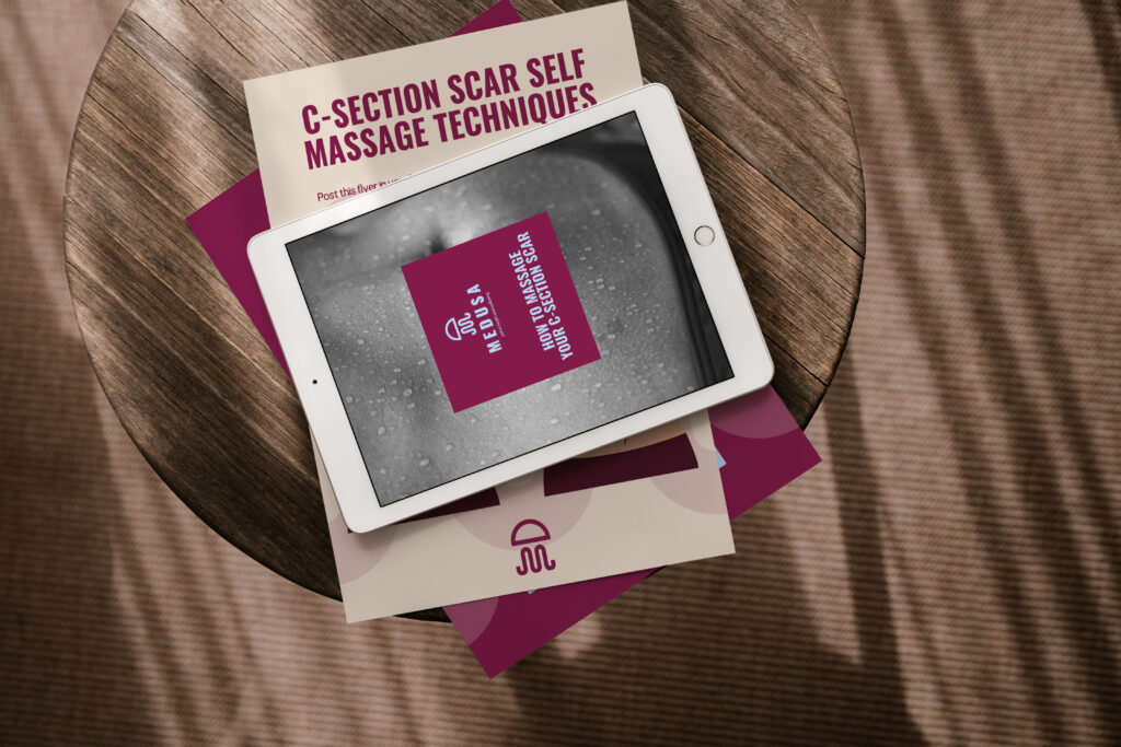 On-brand Medusa document mockup for C-section self-massage technique guide.